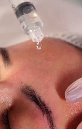 imgi_55_exossomos-aad